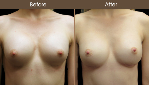 20202805152347_B73-Front